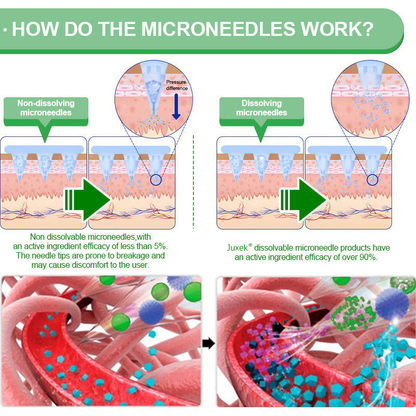 Juxek® Slimming Microneedle Patches